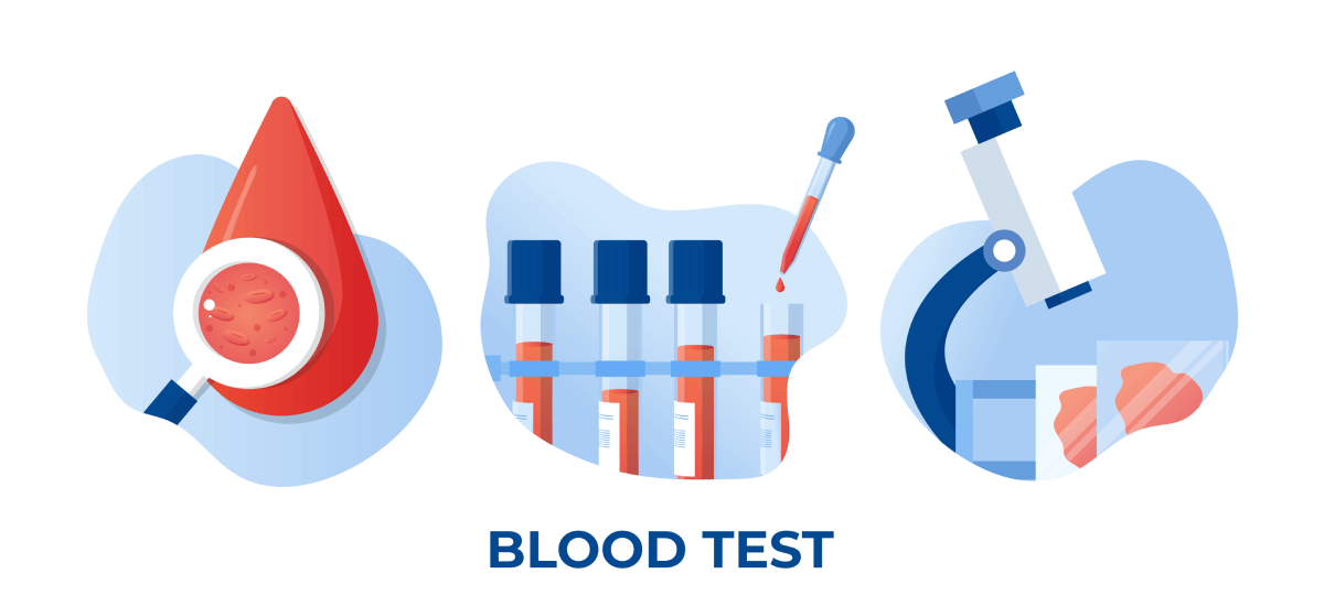 All you need to know about MCHC Blood Tests: Types & Methods